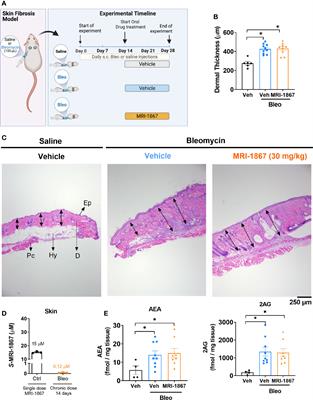 Peripheral Hybrid CB1R and iNOS Antagonist MRI-1867 Displays Anti-Fibrotic Efficacy in Bleomycin-Induced Skin Fibrosis